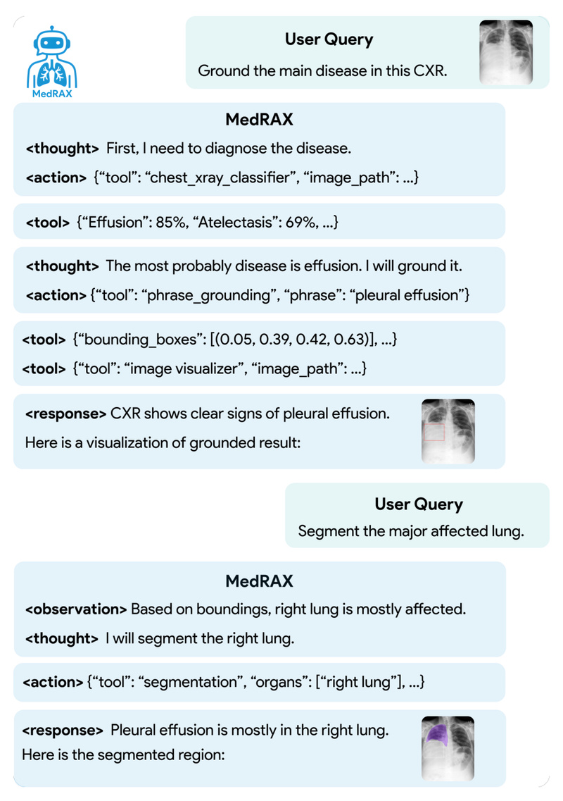 MedRAX: Unified AI Agent for Complex Chest X-ray Reasoning Without Retraining